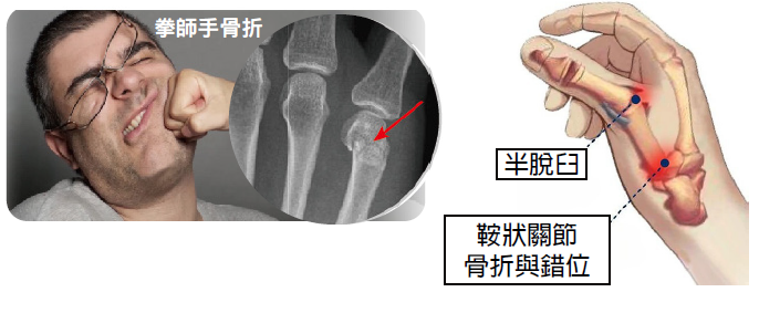 Hand injuries overview 1